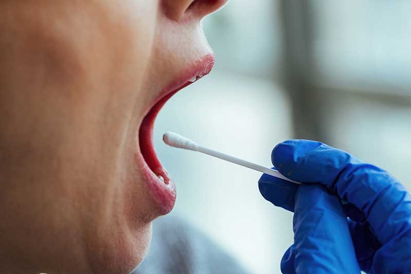Saliva Test for Meth