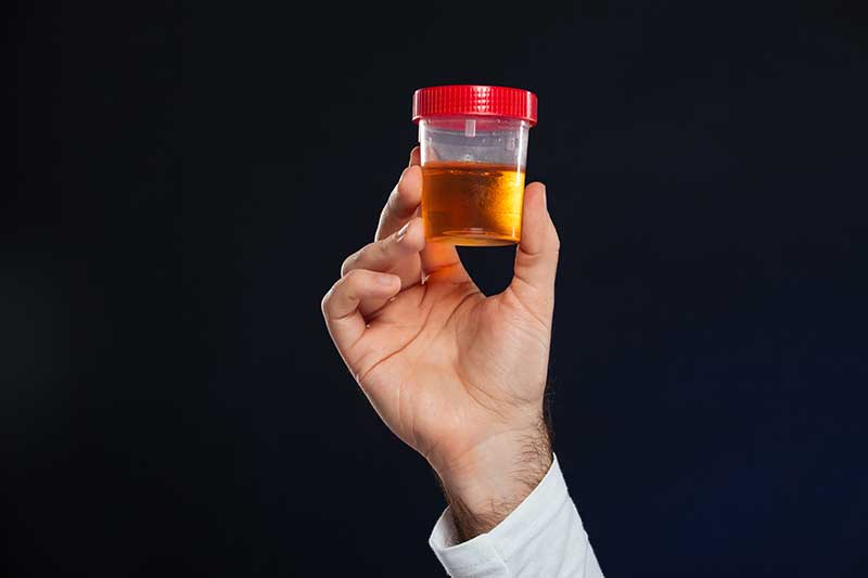 Urine Test for Meth